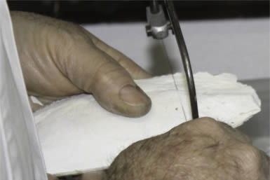 Sawing end off bone